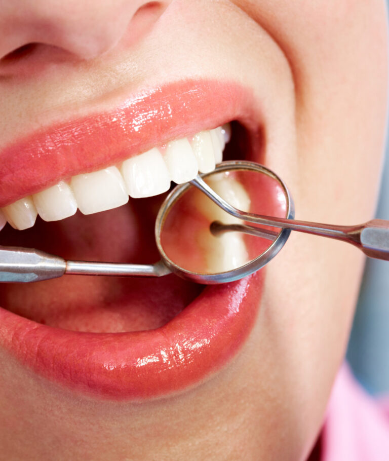 Restauração Dentária em Mogi Guaçu restauração dental